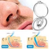 Anti-Snoring Corrector Snore Prevention Elimination Nose Clip Health  