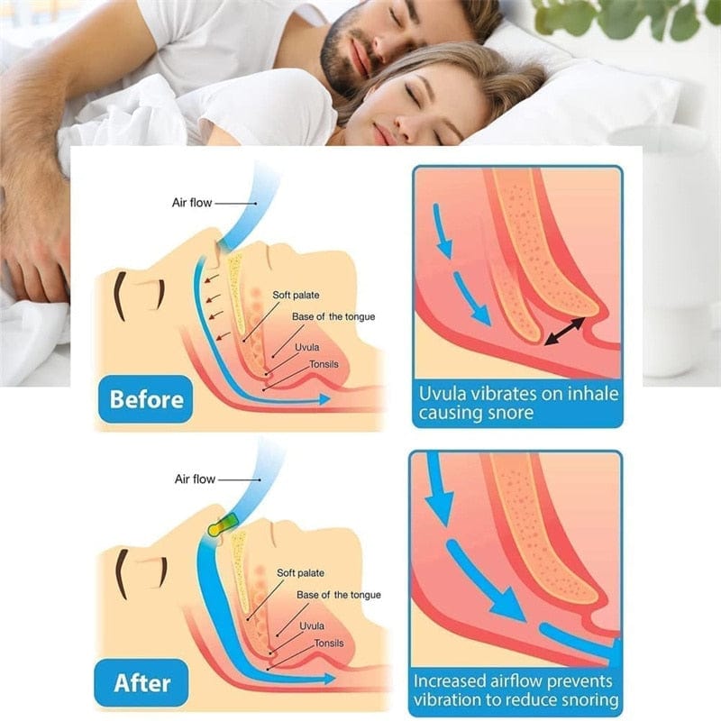 Night time Breathing Aid  Sleep Comfort Nose Clips Health  