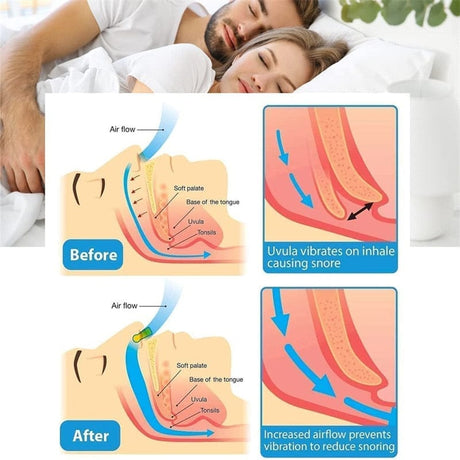 Night time Breathing Aid  Sleep Comfort Nose Clips Health  