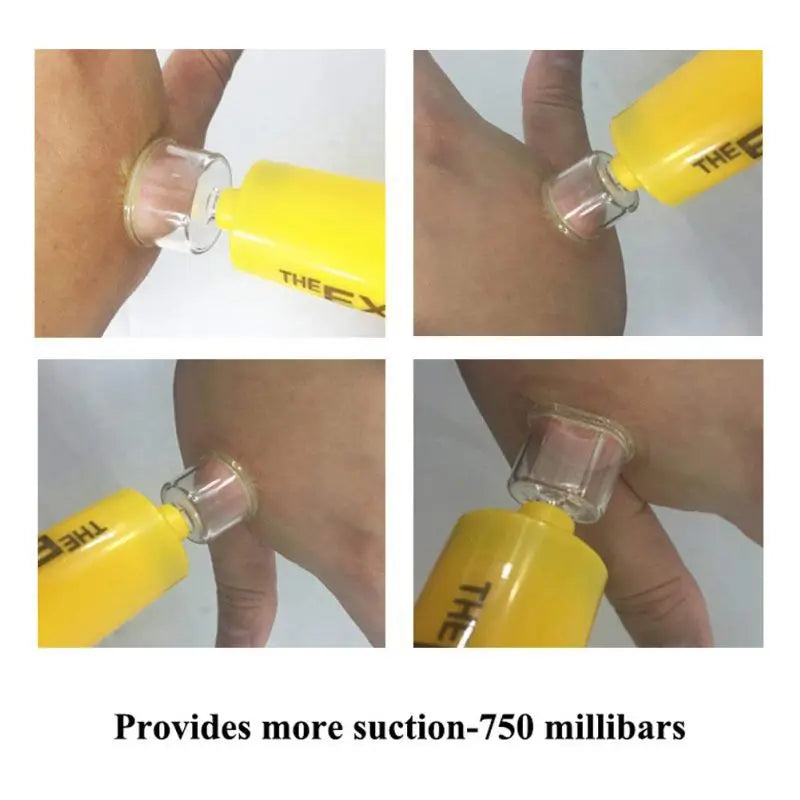 Outdoor Hiking Safe Venom Extractor Kit Snake Bee Bites Health  